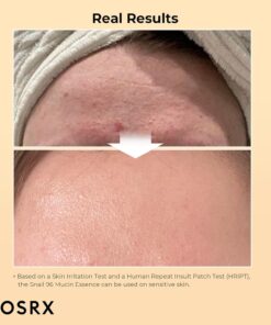 Alternative view of • CORSX Snail serum